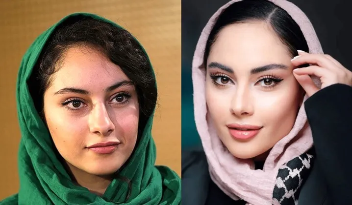 ترلان پروانه قبل و بعد